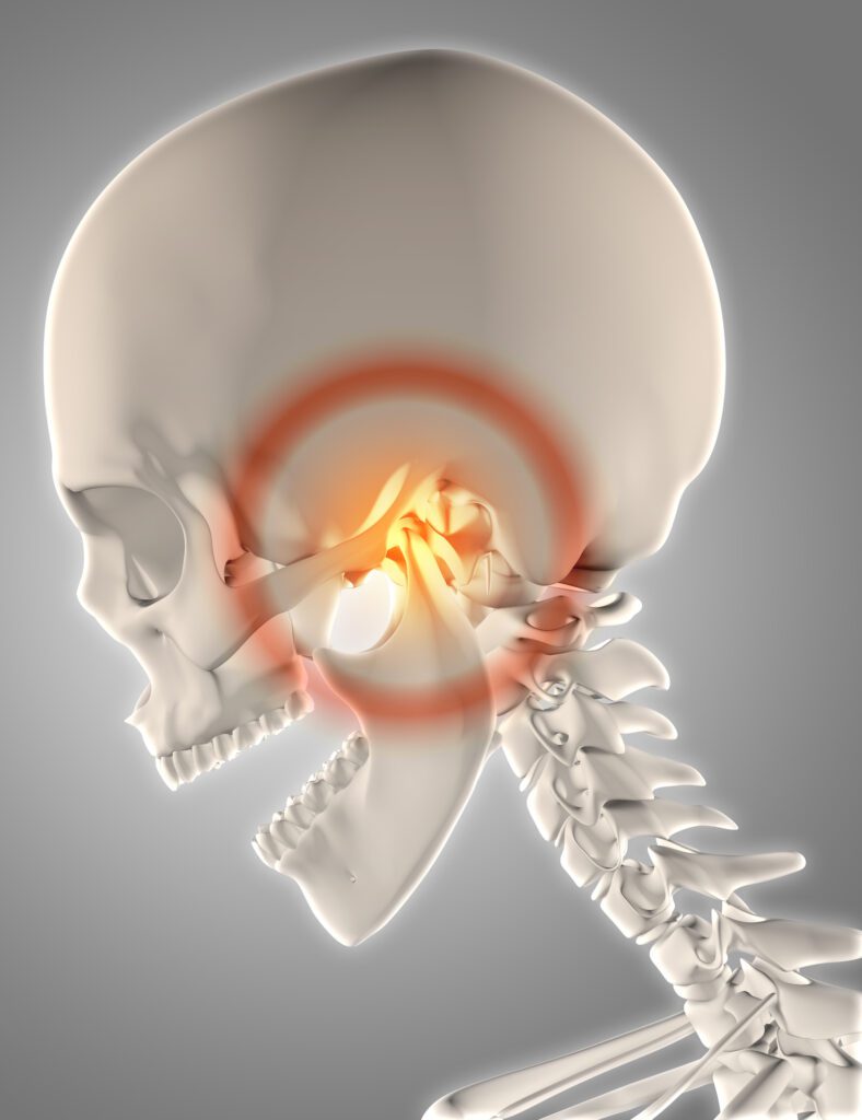 TMJ treatment in Flint, TX